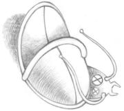 Уничтожение насекомых