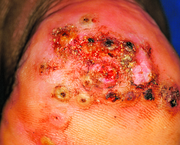 Консультация специалиста Паразитолога