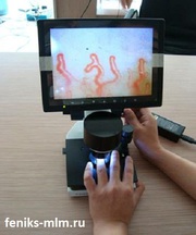 Проверь свои сосуды